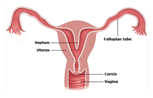 Labeled diagram of a woman's reproductive system