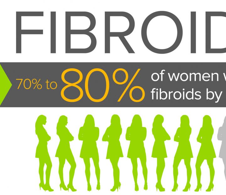 Fibroids