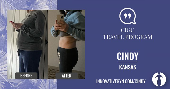 Travel patient perspective before and after weight loss