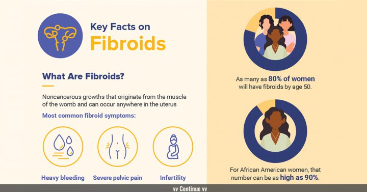 Key facts on fibroids
