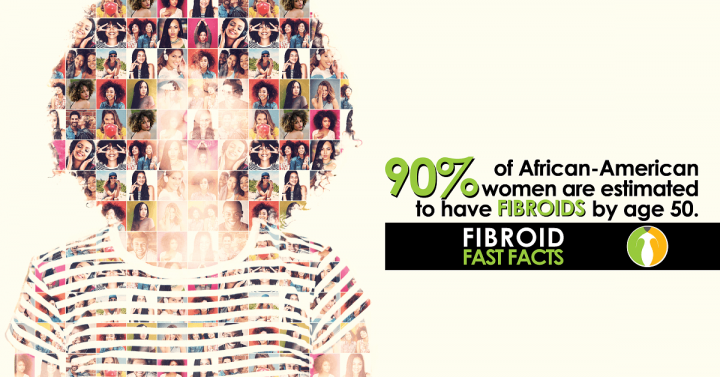 90% of African-American women are estimated to have fibroids by age 50