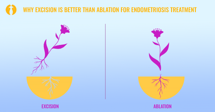 Why excision is better than ablation for endometriosis treatment