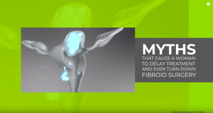Myths that cause a woman to delay treatment for fibroids