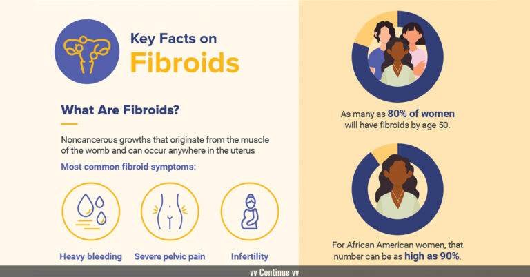 Fibroid Infographic Banner