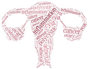 ovarian cyst specialist