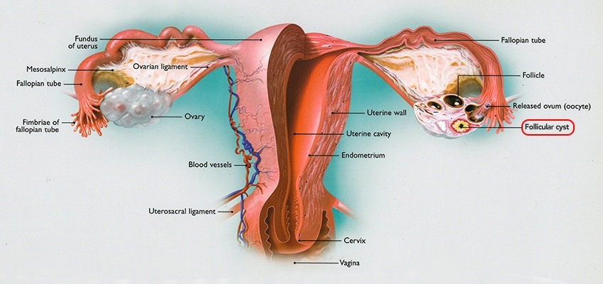 anatomy of pelvis follicular cyst